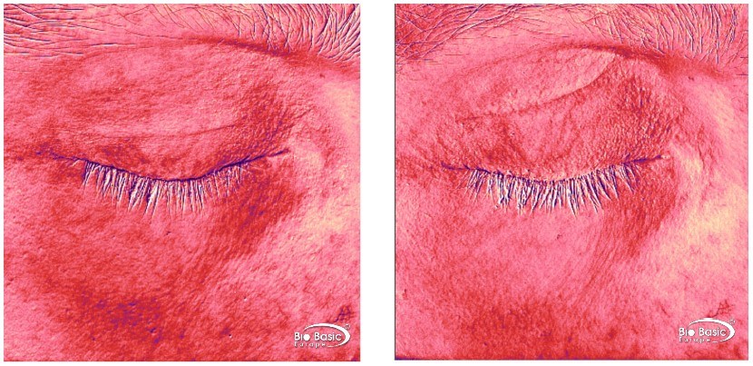 Aevum Vita 621 Redness Reduction